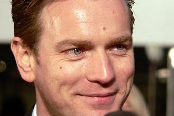 Nốt ruồi ở giữa trán