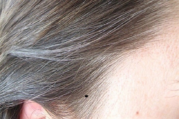 Ý nghĩa 10 nốt ruồi ở trán sát mép chân tóc phụ nữ chuẩn xác