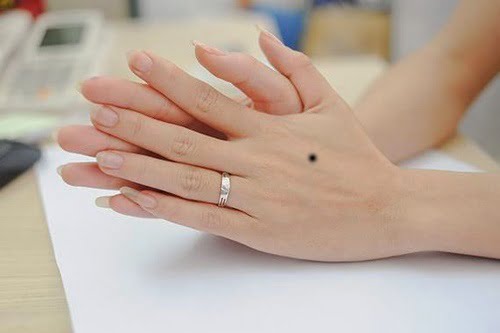 Nốt ruồi trên mu bàn tay nam giới, phụ nữ có ý nghĩa gì?