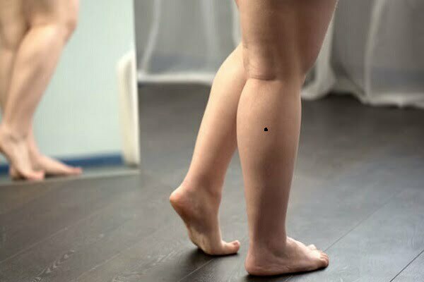 Bắp chân có nốt ruồi ẩn chứa điều gì?