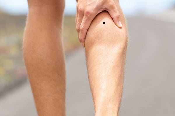 Nốt ruồi ở bắp chân nói lên điều gì?