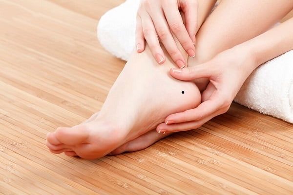 Nốt ruồi ở gót chân có ý nghĩa gì?