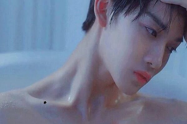 Xương đòn đàn ông có nốt ruồi