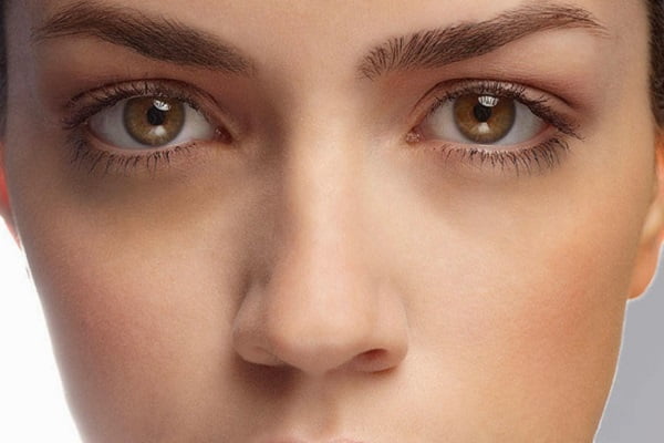 Đặc điểm nhận biết mắt trắng dã